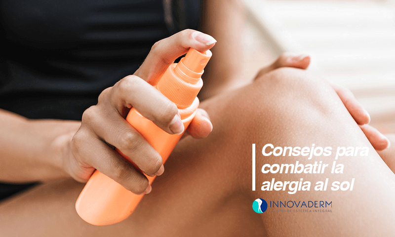 Consejos para combatir la alergia al sol