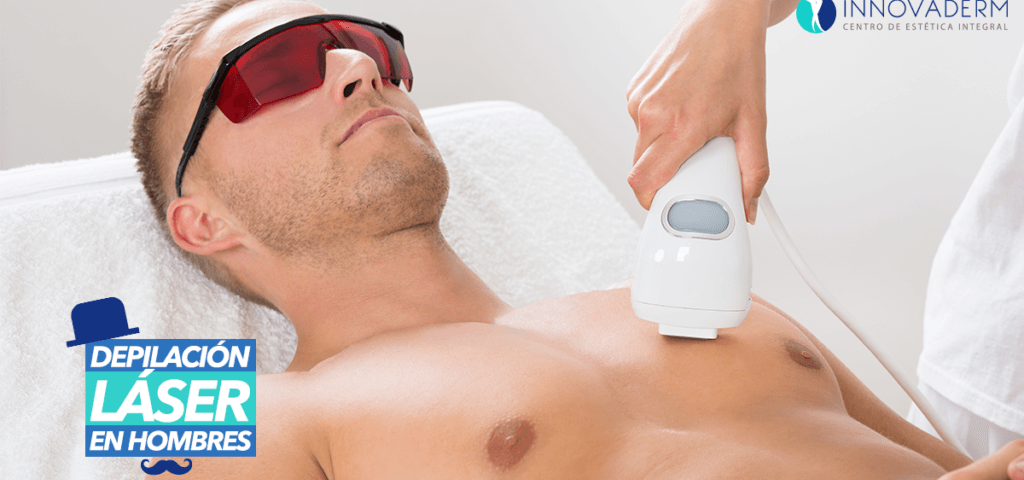 Depilación láser en hombres