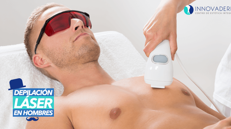 Depilación láser en hombres