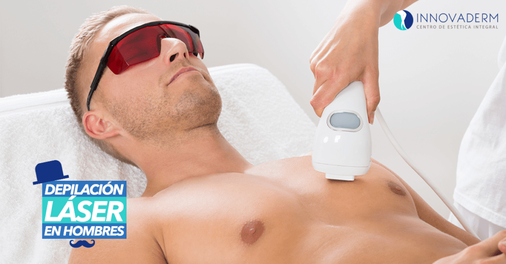 Depilación láser en hombres