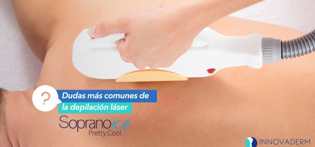 Dudas más comunes de la depilación láser con Soprano Ice