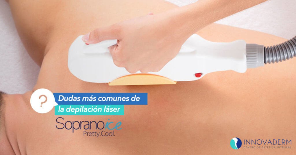 Dudas más comunes de la depilación láser con Soprano Ice