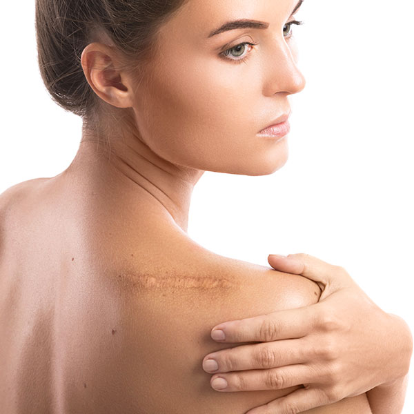 Tratamiento Masaje de Cicatrices (10 sesiones)